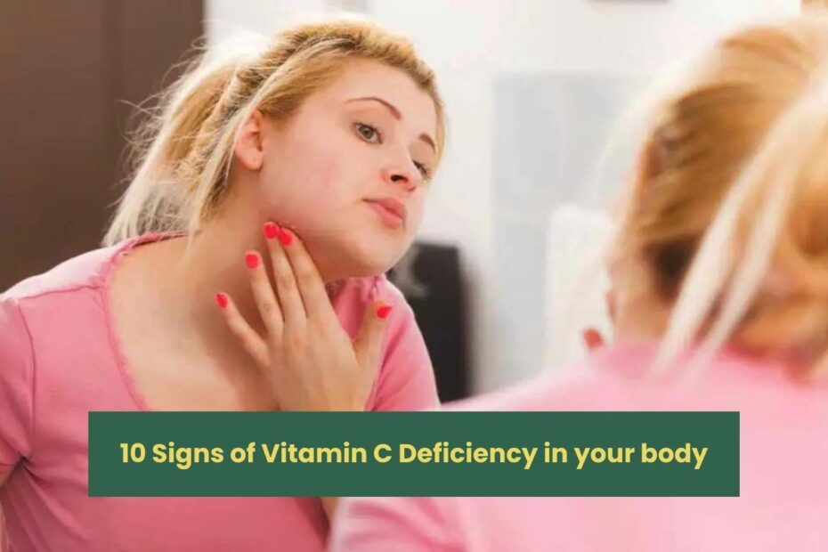 10 Signs of Vitamin C Deficiency in your body