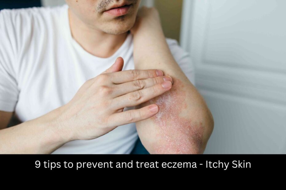 9 tips to prevent and treat eczema - Itchy Skin